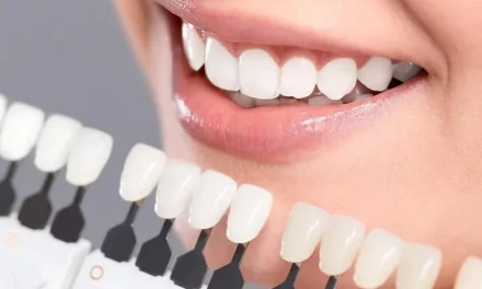 Veneer Gigi: Tren Kecantikan Gigi Yang Sedang Booming